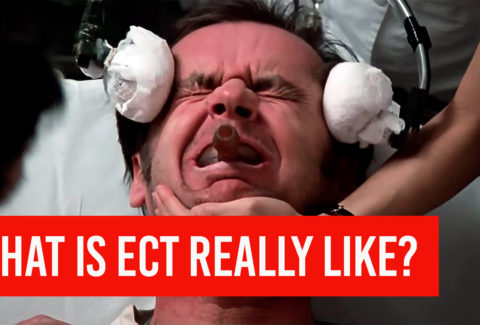 electroconvulsive therapy ect what is it